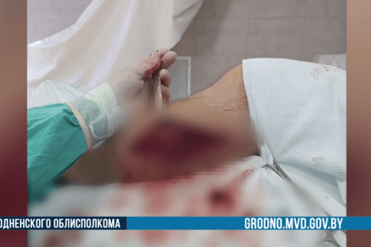 Гродзенская міліцыя паведаміла аб шпіталізацыі мужчыны, які атрымаў агнястрэльныя раненні ў Польшчы